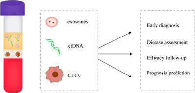 Small extracellular vesicles in breast cancer brain metastasis and the prospect of clinical application